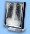 878584_SIEMENS_SMD19200D.jpg-SIEMENS_SINGLE_HEAD_GRAY_SCALE_GRADE_LCD